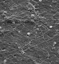 Biofilm mit Mikroorganismen