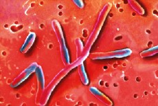 legionella control