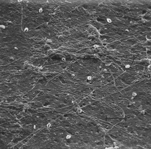 legionella in biofilm